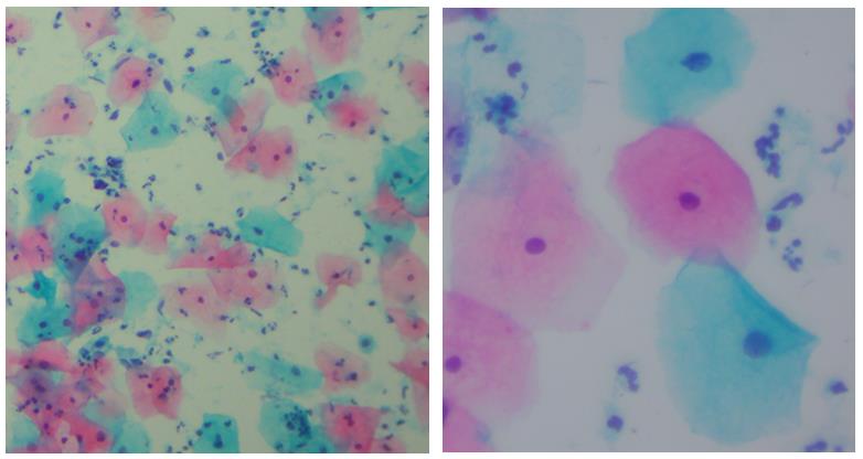 巴氏染色液圖整合.jpg 巴氏染色液圖整合.jpg